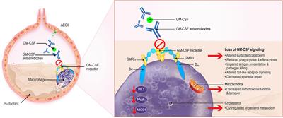 Frontiers The Role of GM CSF Autoantibodies in Infection and